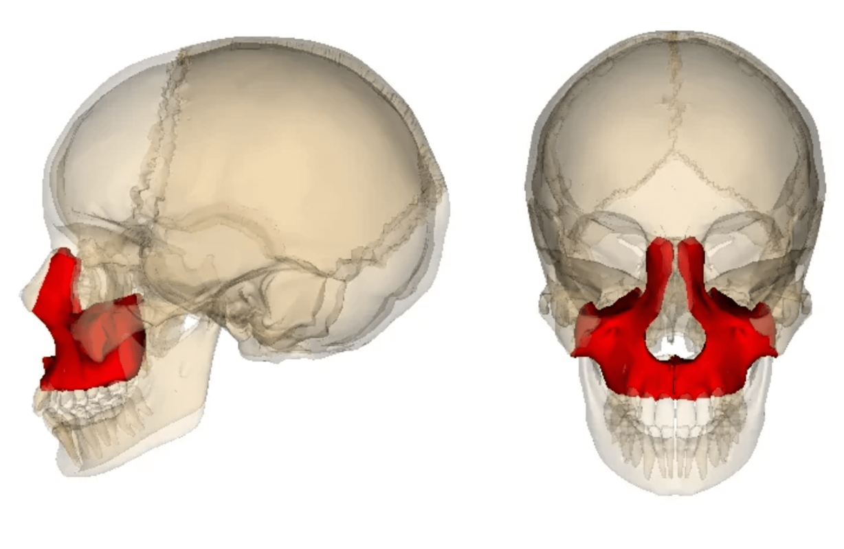 chụp x-quang mặt thấp hoặc mặt cao