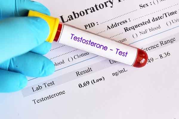 Quy trình Xét nghiệm Định lượng Testosterone