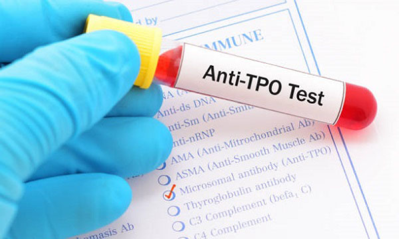 Định lượng Anti TPO