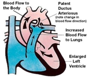 Ống động mạch