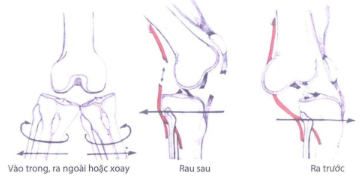 Phân loại trật khớp gối theo Kennedy
