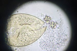 Bệnh sán lá gan nhỏ