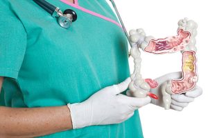 Hiểu biết về các yếu tố nguy cơ của bệnh ung thư đường tiêu hoá là rất quan trọng