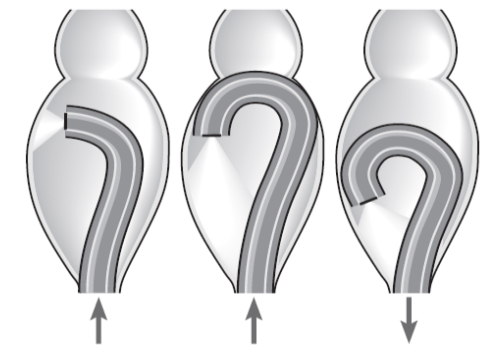 Quặt ngược ống soi để quan sát trực tràng