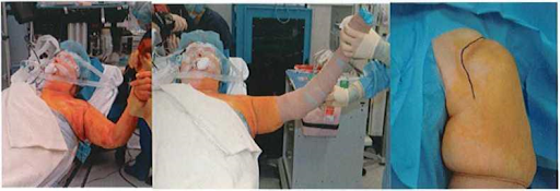 Trải săng vô trùng