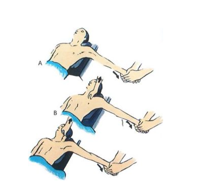 Cách nắn trật khớp ức đòn ra trước