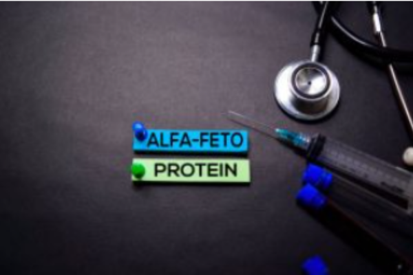 AFP là một dấu ấn sinh học trong chẩn đoán ung thư gan