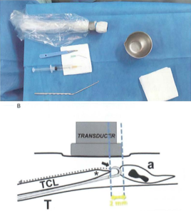 Nội soi 1 ngõ vào gan tay
