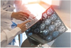 Việc phân biệt các bệnh lý khác với nhồi máu não là rất quan trọng