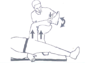 Nắn trật khớp háng theo phương pháp Kocher