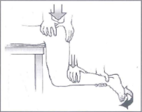 Nắn trật khớp háng theo phương pháp Djenalidze-Stimson