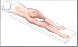 Tư thế bệnh nhân trước mổ