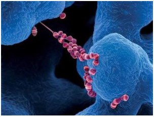 Viêm màng não do Streptococcus suis