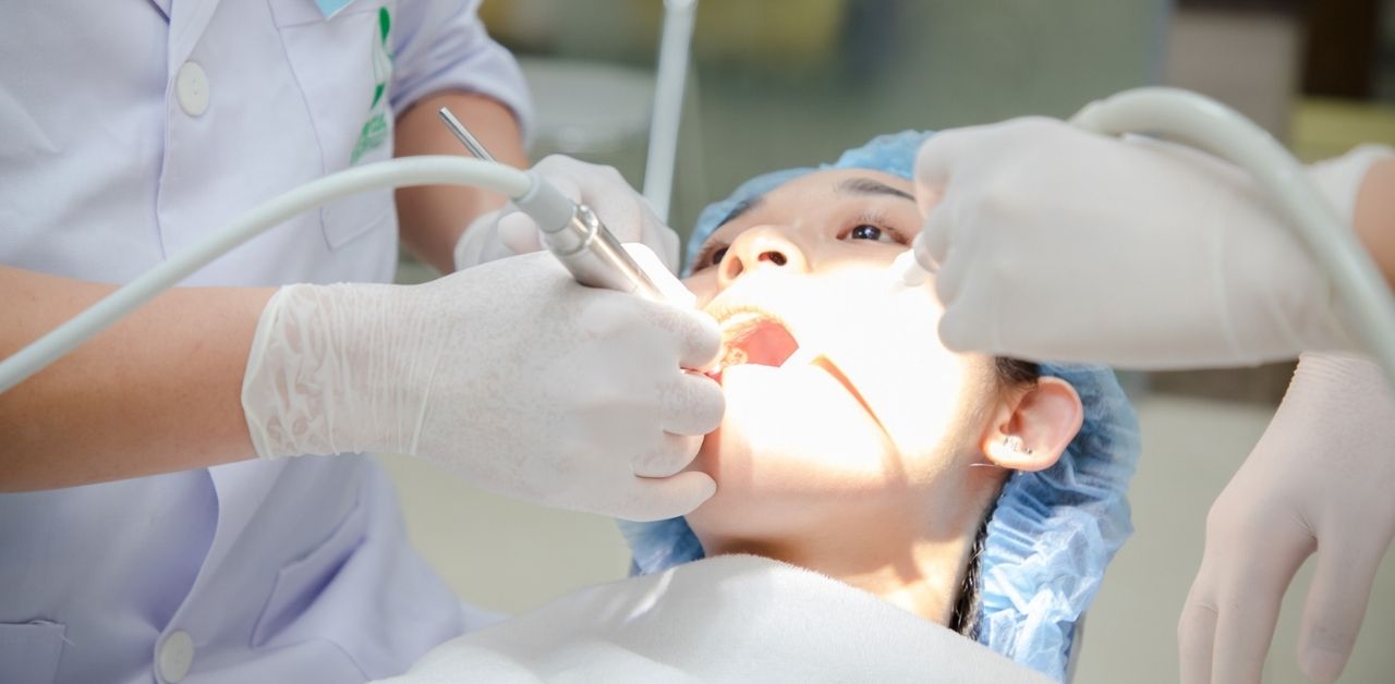 Chụp tủy bằng MTA