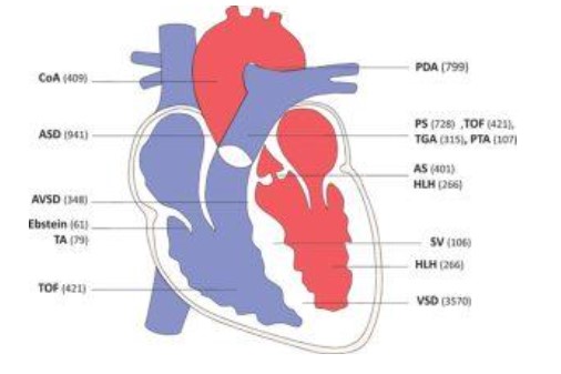 Các vị trí dị tật tim bẩm sinh