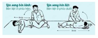 Cách xoay trở và ngồi dậy cho bệnh nhân sau đột quỵ não