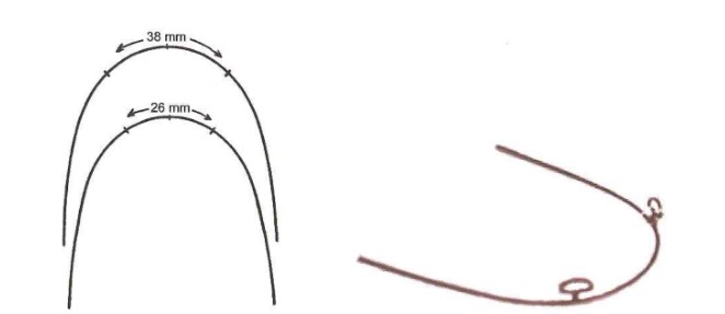 Ứng dụng phân tích Bolton trong chọn kích thước loop.