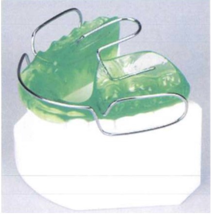 Khí cụ bionator (Khí cụ Balters).