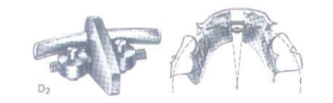 Ốc nới rộng dạng rẻ quạt dùng cho hàm dưới.