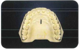 Xác định vị trí đặt ốc.