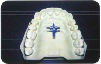 Đặt ốc vào vị trí đã được xác định.