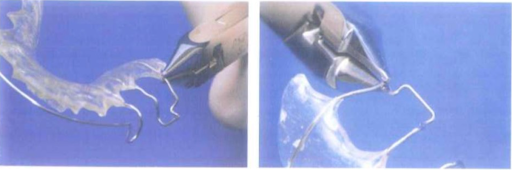 Móc Adams và điều chỉnh trên lâm sàng.