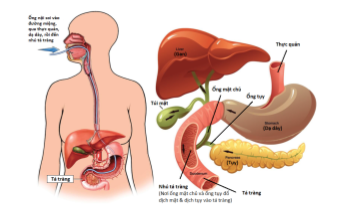 Ứng dụng ERCP trong lấy sỏi, giun đường mật