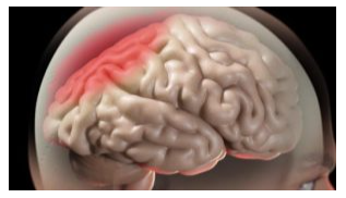 Hướng dẫn ghi điện não đồ thường quy