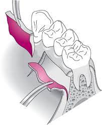 Hình ảnh minh họa