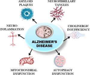 Cơ chế bệnh sinh Alzheimer