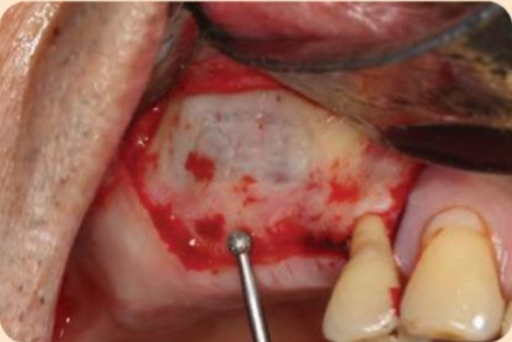 Sử dụng mũi khoan kim cương tròn để thiết kế cửa sổ