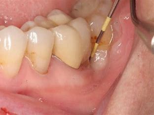 Hình ảnh minh họa