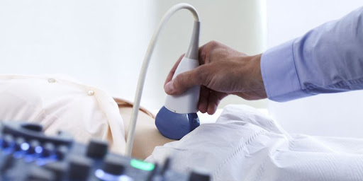 Hình ảnh minh họa siêu âm sỏi thận